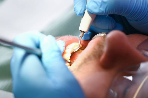 Best Emergency Treatment for Jaw Pain or Injury in Breinigsville, PA
